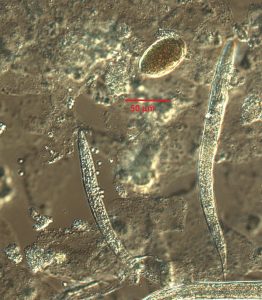 Збудник Strongyloides stercoralis (кишкова вугриця)